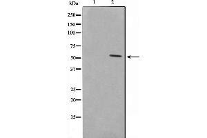 Western blot analysis on HT29 cell lysate using NAB2 Antibody,The lane on the left is treated with the antigen-specific peptide. (EGR1 + EGR2 antibody)