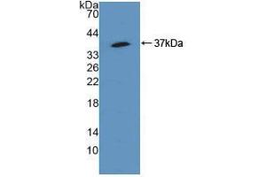 Western blot analysis of recombinant Human SQSTM1. (SQSTM1 antibody  (AA 136-400))