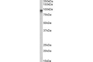 ABIN190848 (2µg/ml) staining of Human Pancrease lysate (35µg protein in RIPA buffer). (Neuroligin 2 antibody  (Internal Region))