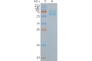 Human A5-Nanodisc, Flag Tag on SDS-PAGE (SLC1A5 Protein)