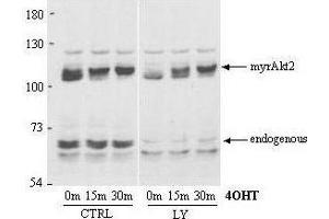 Western Blot of Rabbit Anti-AKT2 antibody. (AKT2 antibody  (AA 455-468))