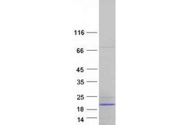 ATP5F1D Protein (Transcript Variant 2) (Myc-DYKDDDDK Tag)