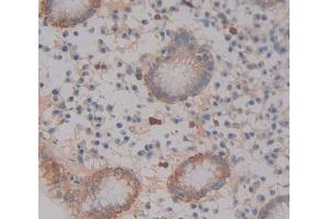 IHC-P analysis of Kidney tissue, with DAB staining. (ABCA12 antibody  (AA 1346-1577))