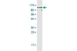 Western Blot detection against Immunogen (102. (CD44 antibody  (AA 1-699))