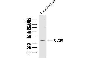 Mouse lymph node lysates probed with CD20 Polyclonal Antibody, Unconjugated (bs-20639R) at 1:300 overnight at 4˚C. (CD20 antibody  (AA 151-250))
