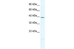 WB Suggested Anti-PITX2 Antibody Titration:  2. (PITX2 antibody  (N-Term))