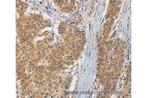 Immunohistochemistry of Human brain  using FASTK Polyclonal Antibody at dilution of 1:30 (FASTK antibody)