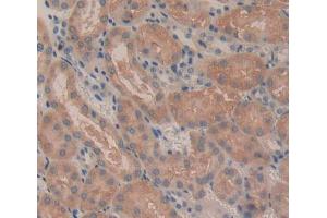 IHC-P analysis of Kidney tissue, with DAB staining. (CROT antibody  (AA 410-612))