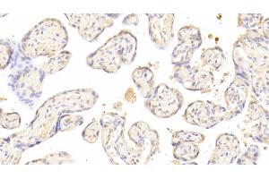 Detection of ACVA in Human Placenta Tissue using Polyclonal Antibody to Activin A (ACVA) (ACVA antibody  (AA 44-178))