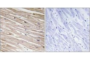 Immunohistochemistry analysis of paraffin-embedded human heart, using PEA-15 (Phospho-Ser104) Antibody. (PEA15 antibody  (pSer104))