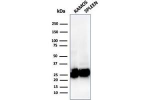 Western Blotting (WB) image for anti-MHC Class II HLA-DP/DQ/DR (HLA-DP/DQ/DR) antibody (ABIN6941388)