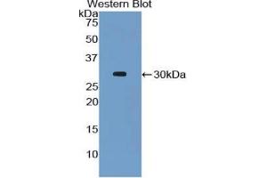 Western Blotting (WB) image for Caspase 8 (CASP8) ELISA Kit (ABIN6574227)