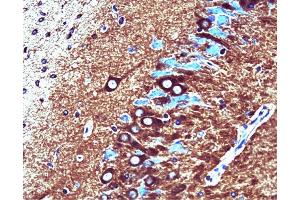 Catalytic alpha (clone 46) staining on rat brain. (PP2A Catalytic alpha (AA 153-309) antibody)