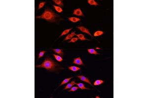 Immunofluorescence analysis of PC-12 cells using SERPIN antibody  at dilution of 1:100 (40x lens). (SERPINA10 antibody  (AA 165-444))