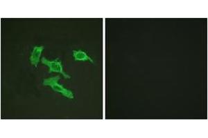 Immunofluorescence (IF) image for anti-Epidermal Growth Factor Receptor (EGFR) (AA 986-1035) antibody (ABIN2888655) (EGFR antibody  (AA 986-1035))