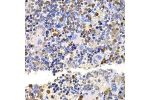 Immunohistochemistry of paraffin-embedded rat spleen using UBE2V2 antibody. (UBE2V2 antibody  (AA 1-145))