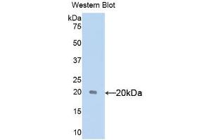 Western blot analysis of the recombinant protein. (SHBG antibody  (AA 222-358))