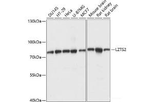 LZTS2抗体