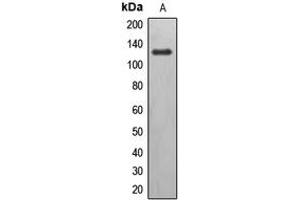 Western blot analysis of EPHB6 expression in Jurkat (A) whole cell lysates. (EPH Receptor B6 antibody  (C-Term))