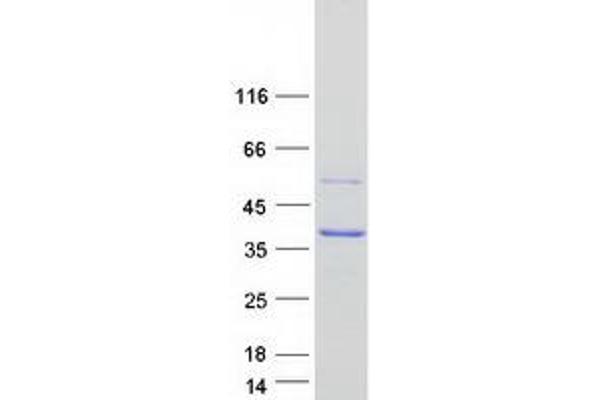 SCAMP1 Protein (Myc-DYKDDDDK Tag)