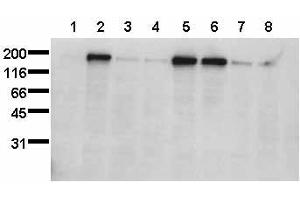 EGFR Transactivation: Serum starved HepG2 cells were treated for 15 minutes as indicated. (EGFR antibody  (pSer1047))
