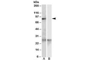 Western blot testing of human heart lysate with SCARF1 antibody at 0. (SCARF1 antibody)