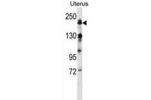 Western Blotting (WB) image for anti-Mitogen-Activated Protein Kinase Kinase Kinase 4 (MAP3K4) antibody (ABIN2998240) (MAP3K4 antibody)