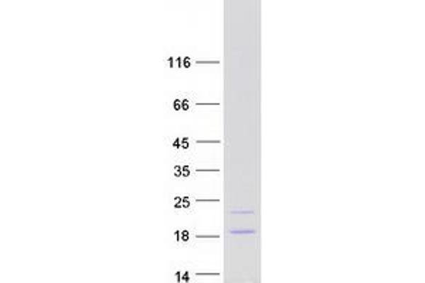 ATP5F1D Protein (Transcript Variant 1) (Myc-DYKDDDDK Tag)