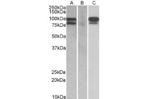 HEK293 lysate (10ug protein in RIPA buffer) overexpressing Human PCSK9 with C-terminal MYC tag probed with ABIN570919 (0. (PCSK9 antibody  (AA 164-175))