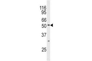 Western blot analysis of JNK3 antibody and mouse brain tissue lysate. (MAPK10 antibody  (AA 1-30))