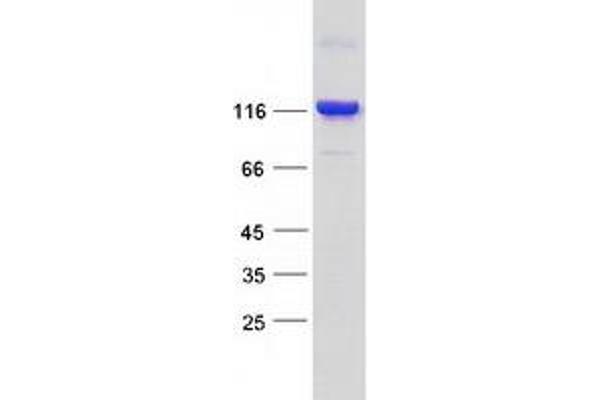 BICD1 Protein (Transcript Variant 1) (Myc-DYKDDDDK Tag)