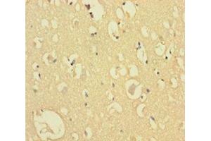 Immunohistochemistry of paraffin-embedded human brain tissue using ABIN7148784 at dilution of 1:100 (CXXC5 antibody  (AA 1-227))