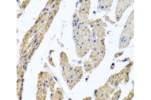 Immunohistochemistry of paraffin-embedded Human esophageal smooth muscle using MRPL12 Polyclonal Antibody at dilution of 1:100 (40x lens). (MRPL12 antibody)