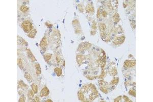 Immunohistochemistry of paraffin-embedded Human stomach using HDAC4 Polyclonal Antibody at dilution of 1:100 (40x lens). (HDAC4 antibody)