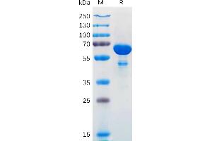 BCL2L1 Protein (AA 1-212) (Fc Tag)