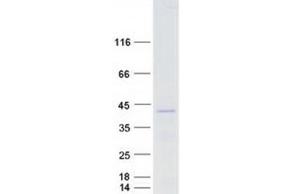 FOXL1 Protein (Myc-DYKDDDDK Tag)