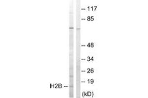 Western blot analysis of extracts from Jurkat cells, treated with UV 15', using Histone H2B (Ab-14) Antibody. (Histone H2B antibody  (AA 1-50))