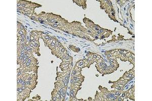 Immunohistochemistry of paraffin-embedded Human prostate using SMN2 Polyclonal Antibody (SMN2 antibody)