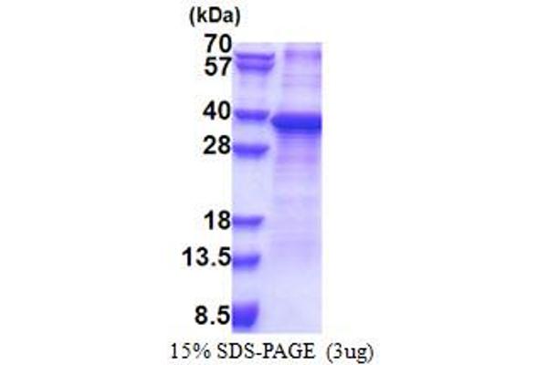 RPS2 Protein (AA 1-293) (His tag)