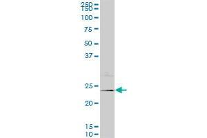 NEUROG1 monoclonal antibody (M06), clone 4A2. (Neurogenin 1 antibody  (AA 82-163))