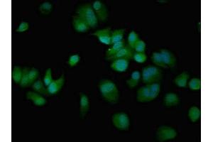 Immunofluorescent analysis of MCF-7 cells using ABIN7148671 at dilution of 1:100 and Alexa Fluor 488-congugated AffiniPure Goat Anti-Rabbit IgG(H+L) (CBP antibody  (AA 2217-2442))