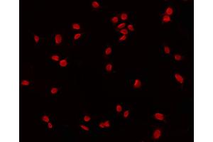 ABIN6268818 staining 293 by IF/ICC. (GATA6 antibody  (Internal Region))