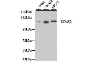 Western blot analysis of extracts of various cell lines, using DDX58 antibody. (DDX58 antibody)
