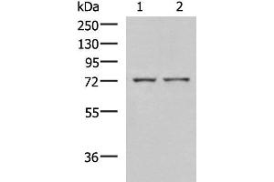 Western blot analysis of Mouse liver tissue and Jurkat cell lysates using ZAP70 Polyclonal Antibody at dilution of 1:800 (ZAP70 antibody)