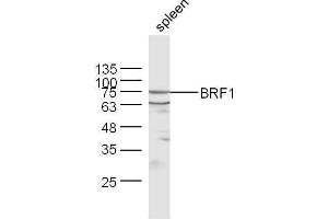 Mouse spleen lysates probed with Rabbit Anti-BRF1 Polyclonal Antibody, Unconjugated  at 1:500 for 90 min at 37˚C. (BRF1 antibody  (AA 501-600))