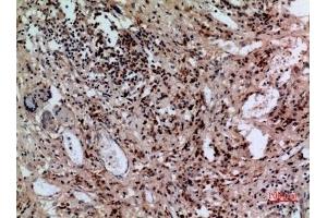 Immunohistochemical analysis of paraffin-embedded human-lung, antibody was diluted at 1:100. (SLC10A1 antibody  (C-Term))