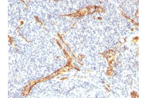 Immunohistochemistry (IHC) image for anti-CD34 (CD34) antibody (ABIN6941175)