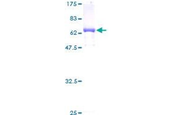 CTH Protein (AA 1-405) (GST tag)