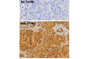 Immunohistochemistry (IHC) image for anti-STIP1 Homology and U-Box Containing Protein 1 (STUB1) antibody (ABIN6254206) (STUB1 antibody)