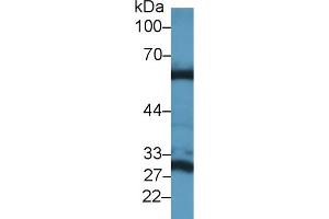 Western blot analysis of Mouse Liver lysate, using Mouse GLS2 Antibody (1 µg/ml) and HRP-conjugated Goat Anti-Rabbit antibody ( (GLS2 antibody  (AA 154-479))